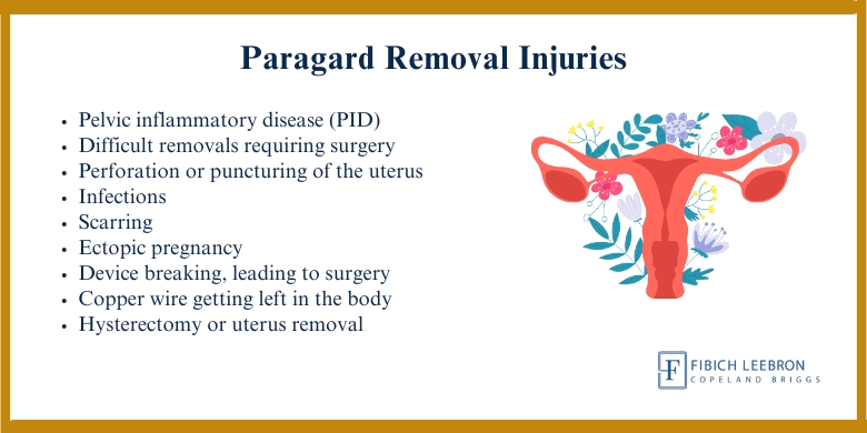 Paragard Removal Injuries