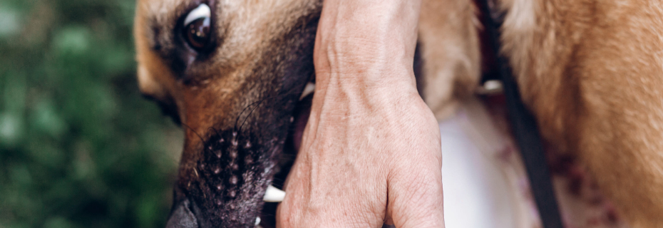 dog bite injury